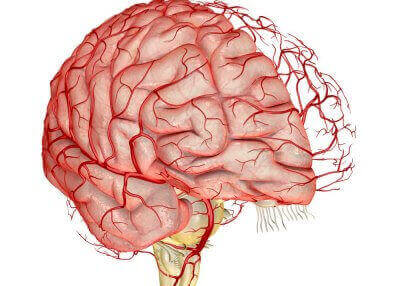 Атеросклероз судин головного мозку