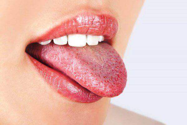 Білий наліт на язику у дорослих: причини. Чому на язиці білий наліт