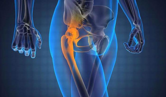Біль у стегні і тазостегновому суглобі: причини і що робити
