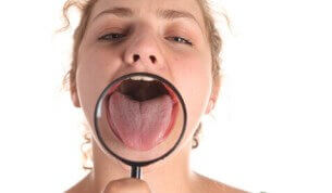 Стоматит на язиці. Чим і як лікувати стоматит на язиці?