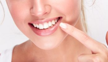 Як відбілити зуби: в домашніх умовах і в клініці