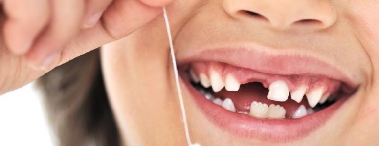 До чого сниться випадання зубів без крові?