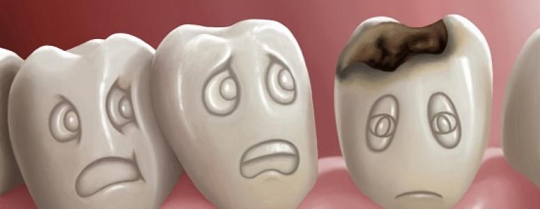 До чого сняться гнилі зуби?