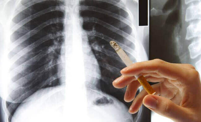 Як очистити легені після куріння: поради і народні рецепти для допомоги організму