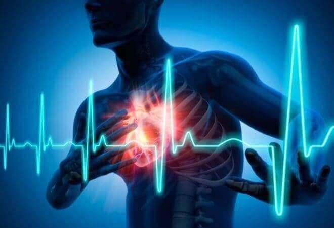 Ускладнення інфаркту міокарда: ранні