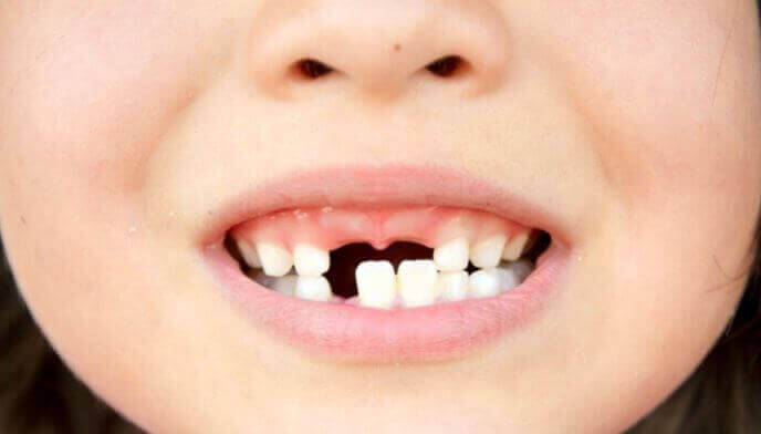 Коли випадають молочні зуби у дітей (Схема)