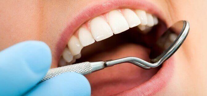 Коричневий наліт на зубах: причини