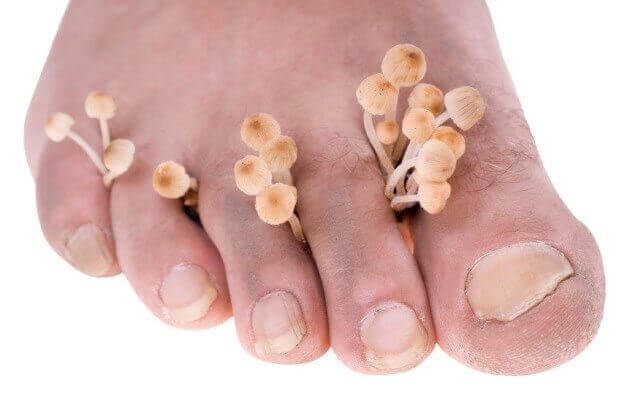 Мазі від грибка нігтів на ногах і руках - ефективні мазі для лікування. Рейтинг (ТОП) найкращих мазей від грибка