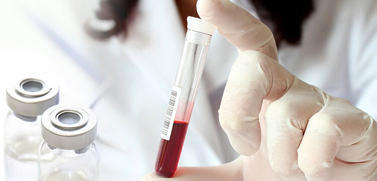 Розшифровка аналізу крові у дітей