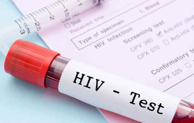 Скільки дійсний аналіз на ВІЛ: годен