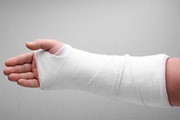 Сонник зламана рука: до чого сниться і що означає сон про зламану руку