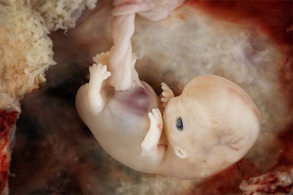 Сонник зародок: до чого сниться і що означає сон про зародка