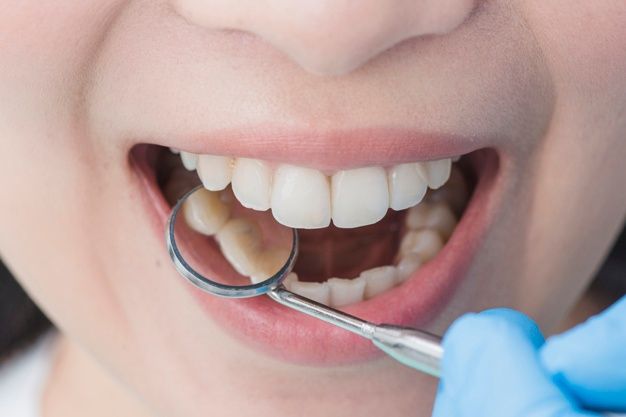 Стоматология в Турции. Почему лечить зубы лучше в Турции?