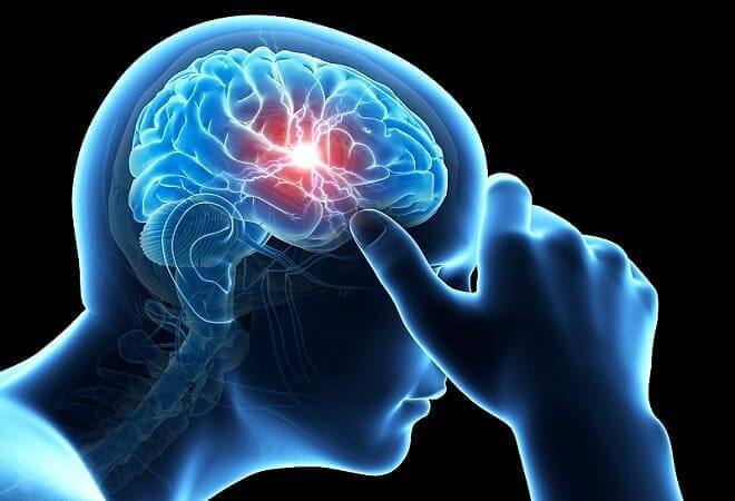 Синус тромбоз головного мозку: венозного