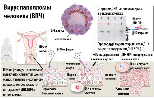 Папіломавірус людини: опис 16 і 31 типу